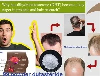 Miks on DHT-st saanud eesnäärme- ja juukseuuringute peamine sihtmärk?