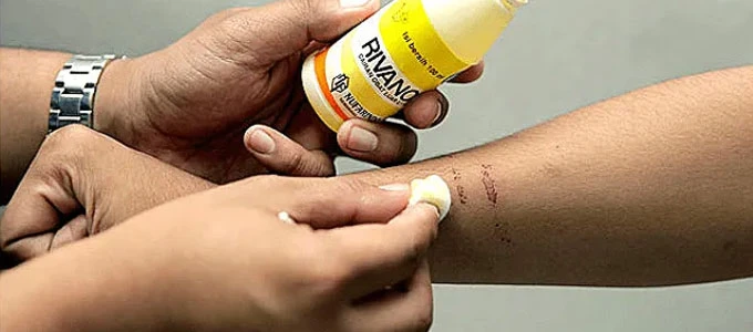 Rivanol use Rivanol use