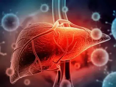 Hepatotoxicity